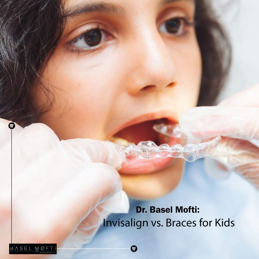 Invisalign vs. Braces for Kids: Choosing the Best Orthodontic Treatment with Dr. Basel Mofti in Dubai