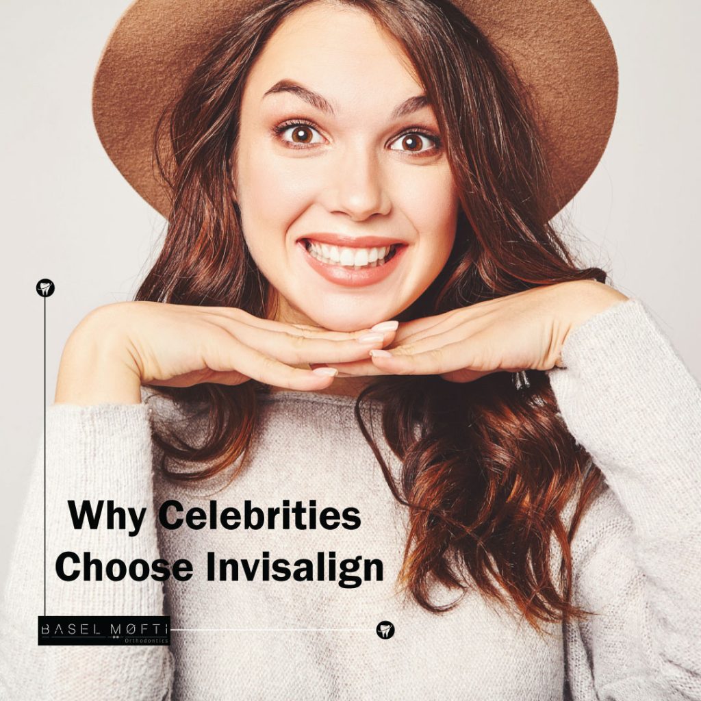 Why Celebrities Choose Invisalign