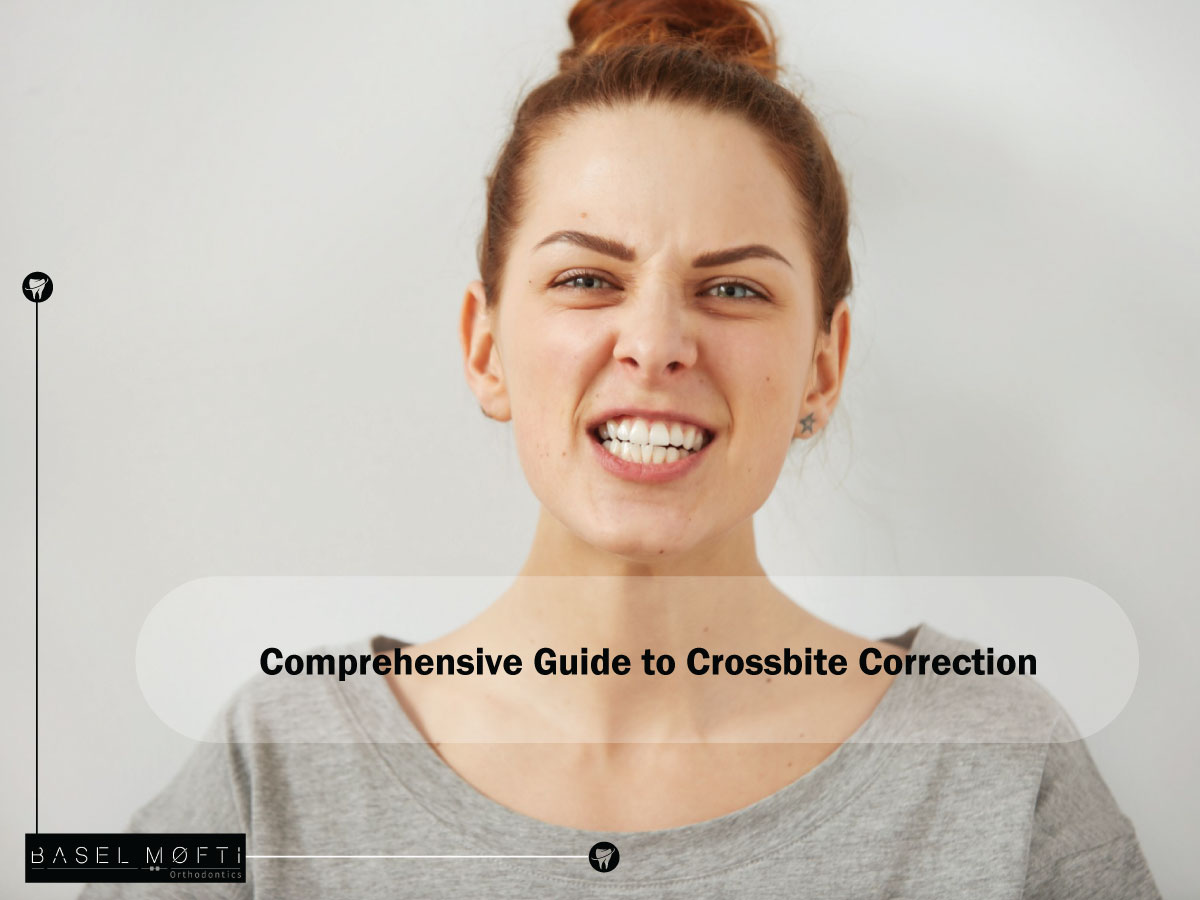 Read more about the article Comprehensive Guide to Crossbite Correction in Dubai