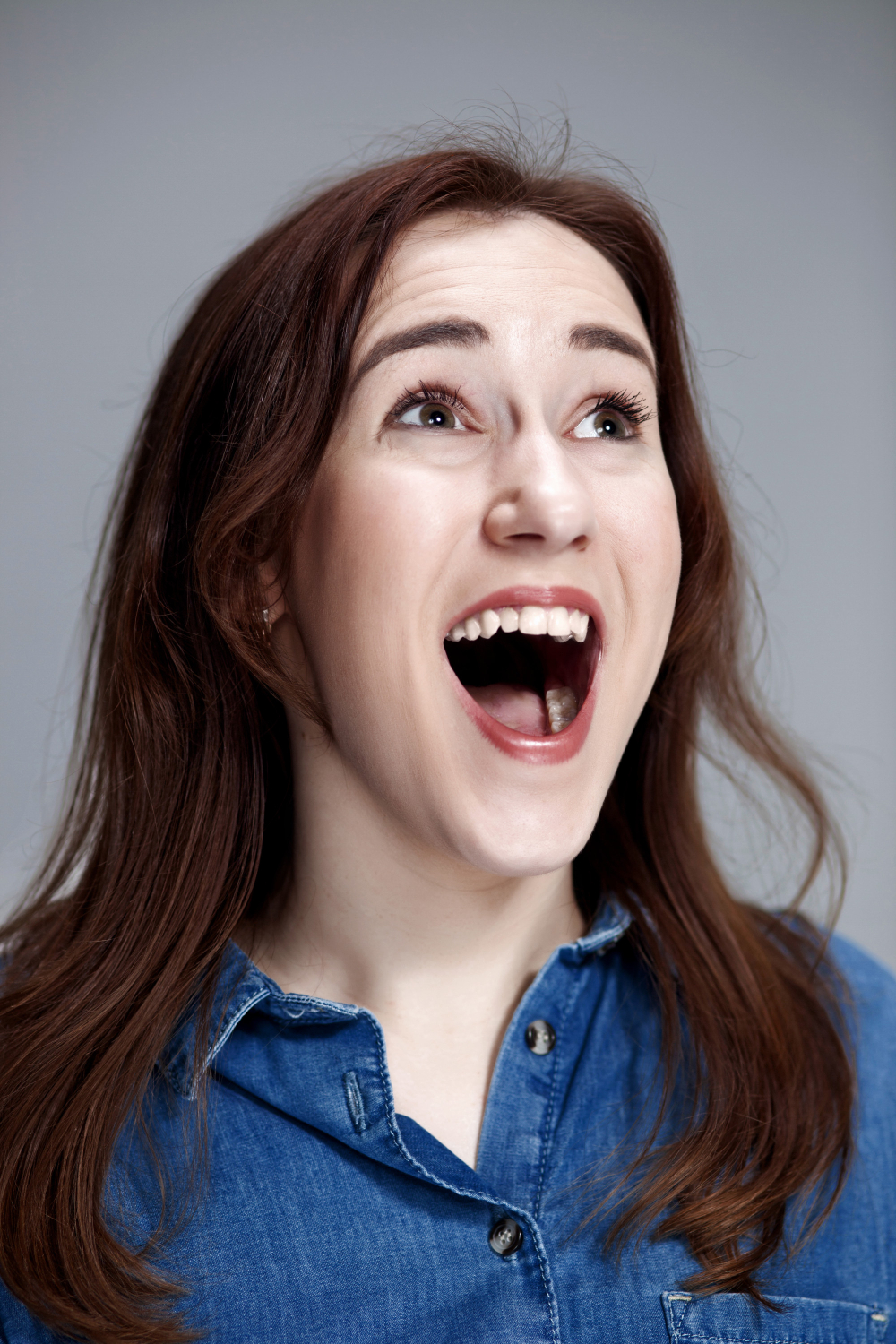 Dubai-Crossbite Correction in Adults