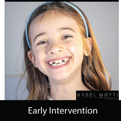 Early-Intervention--Orthodontist