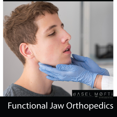 Functional-Jaw-Orthopedics