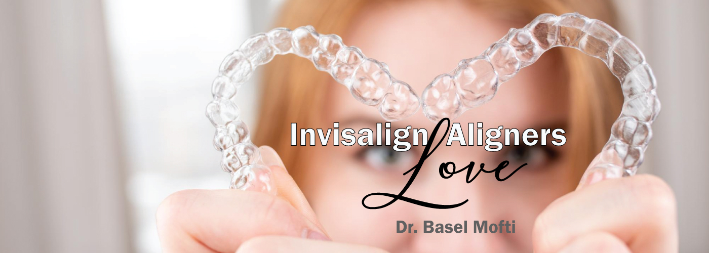 Invisalign-Love
