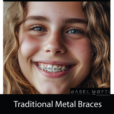 Traditional-Metal-Braces--Orthodontist