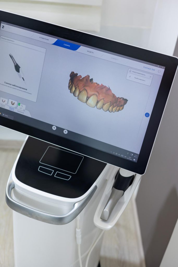 Braces for Adults
