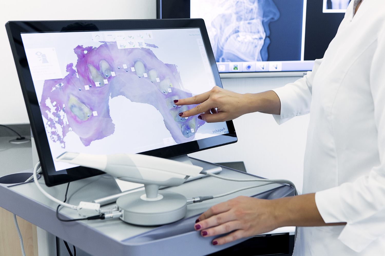 Read more about the article Smart Braces Dubai: Straighten Your Smile for Better Health & Confidence