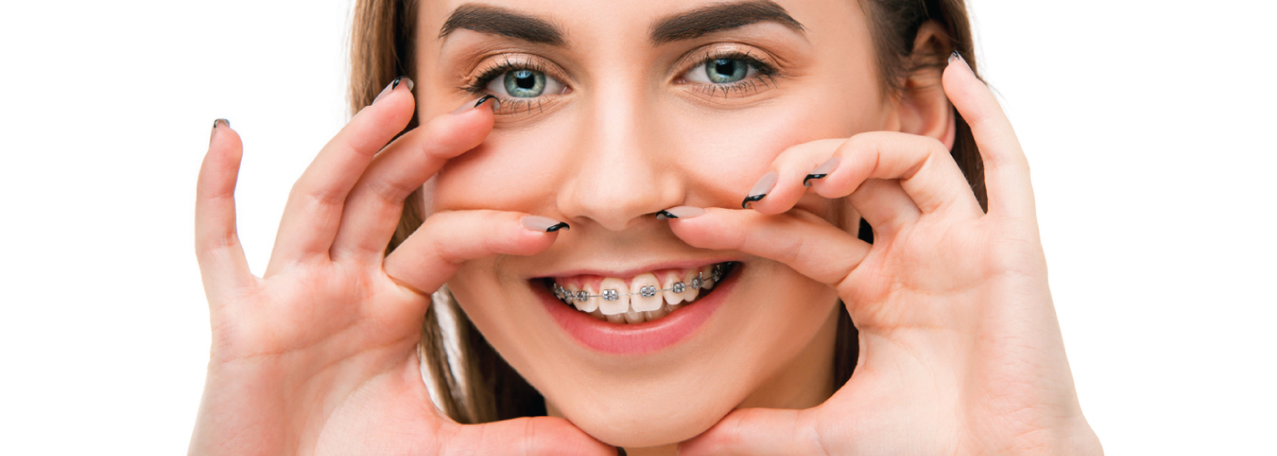 Smart-Braces--Orthodontist-Dubai