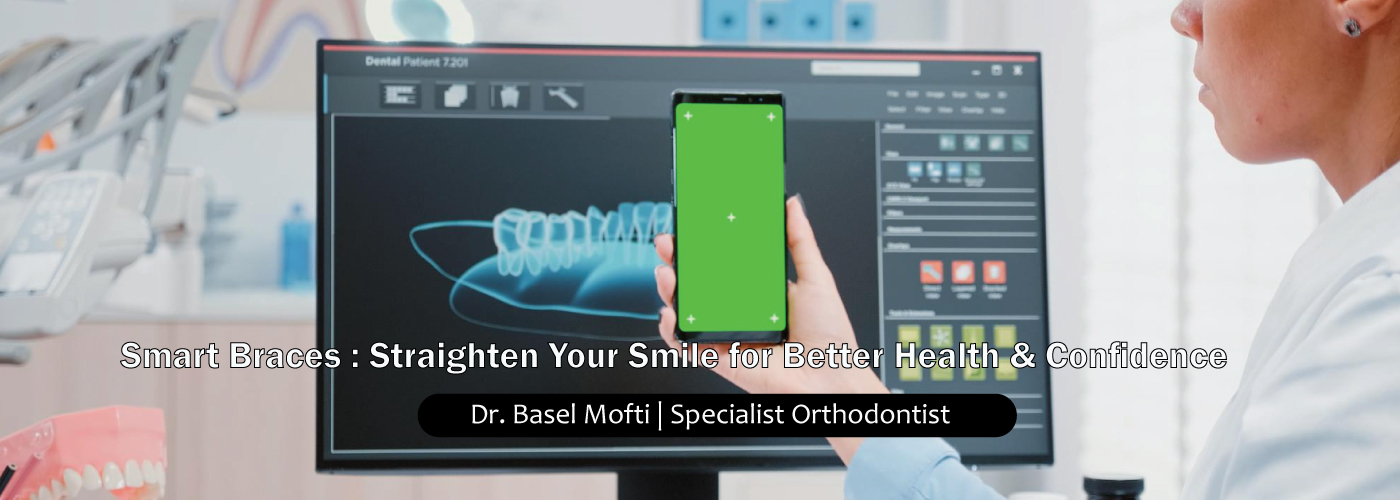 Smart-Braces-in-Dubai