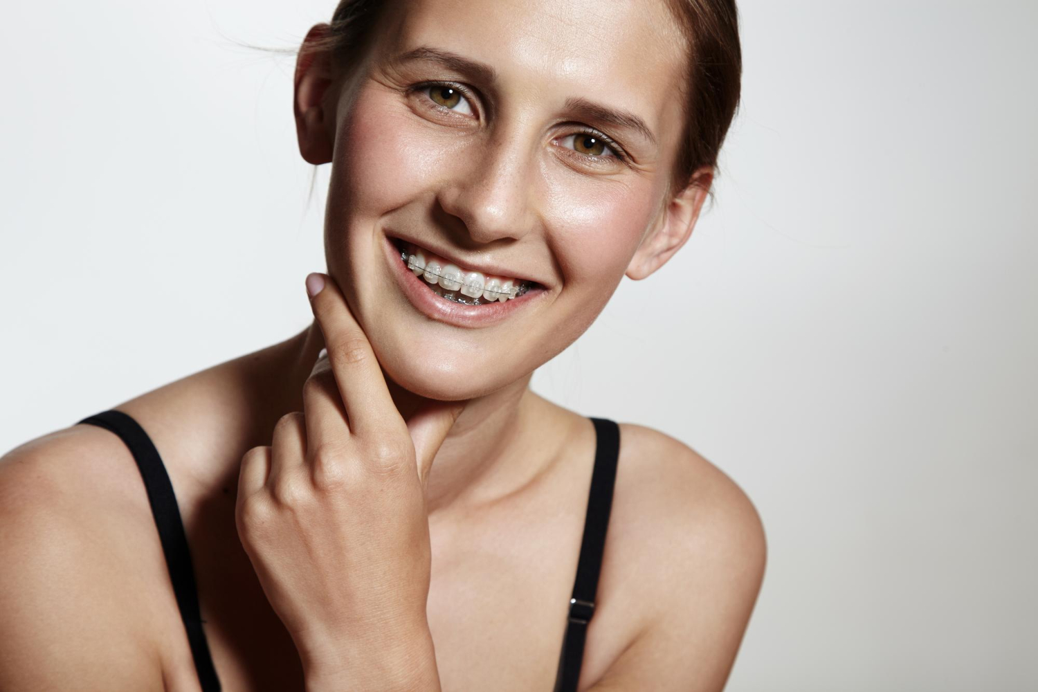 White braces are transforming smiles